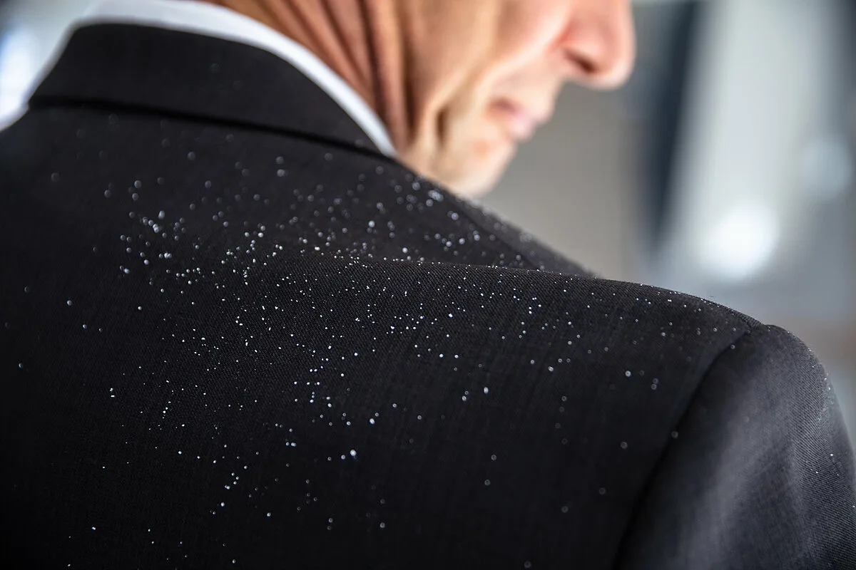 Žiadne šampóny a chemikálie: zbavte sa lupín pomocou tejto koreniny, ktorú už máte doma.