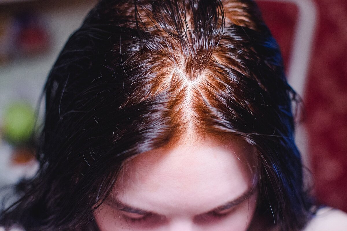 Ako sa navždy zbaviť šedín: domáci prostriedok bez farbív a chemikálií, ktorý obnovuje farbu vlasov