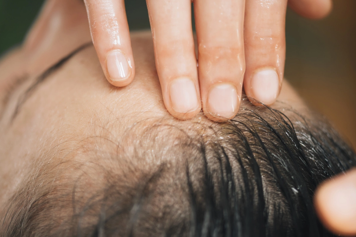 Rozmarínová voda na vlasy: prečo sa odporúča používať a na čo slúži