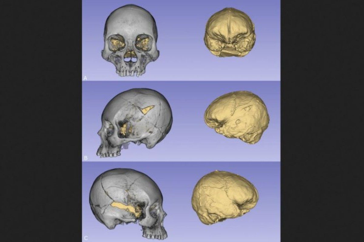 Vedci zistili, prečo majú praveké múmie z Atacamy menší mozog, ako je bežné